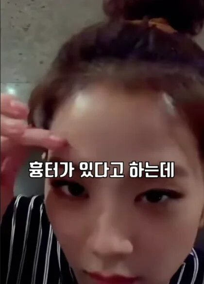 Жисүгийн хүүхэд насны сорвитой холбоотой түүх ахынх нь бэлгийн гэмт хэргийн дуулианы үеэр дахин сөхөгдөв 1 Жисүгийн хүүхэд насны сорвитой холбоотой түүх ахынх нь бэлгийн гэмт хэргийн дуулианы үеэр дахин сөхөгдөв