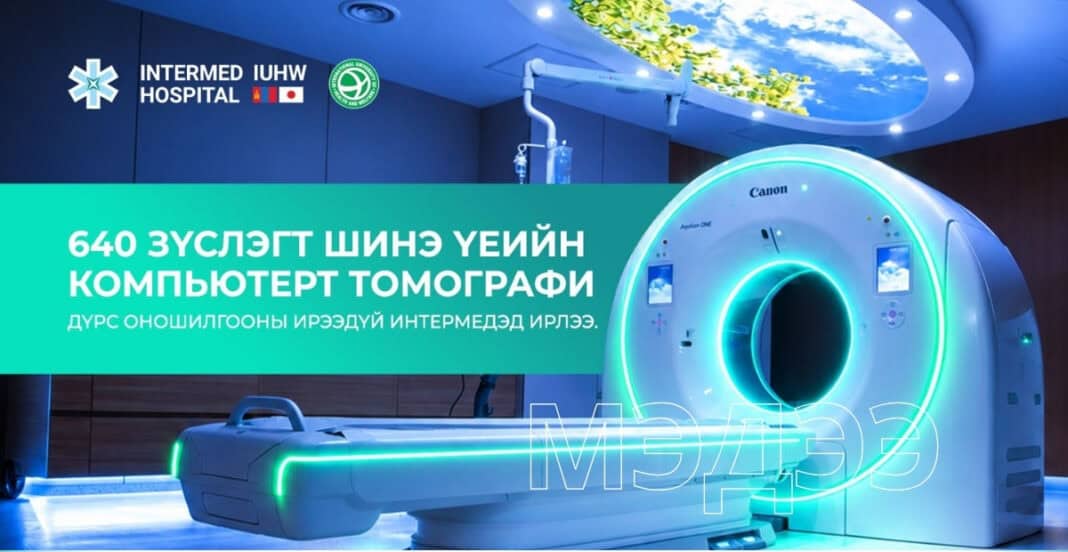 Монголд анх удаа 640 зүслэгт шинэ үеийн CT төхөөрөмжийг Интермед эмнэлэг нэвтрүүллээ